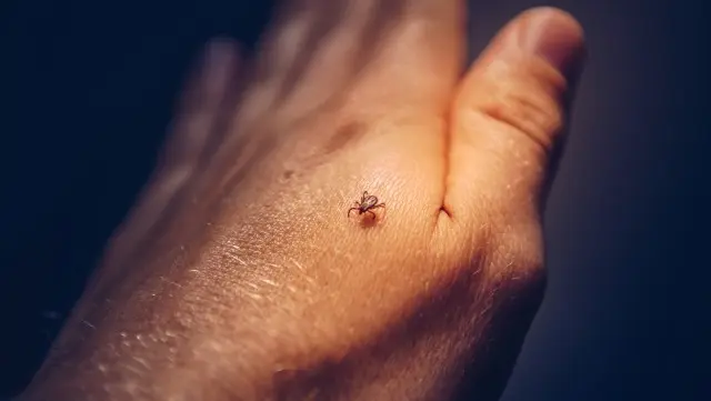 Tick Control